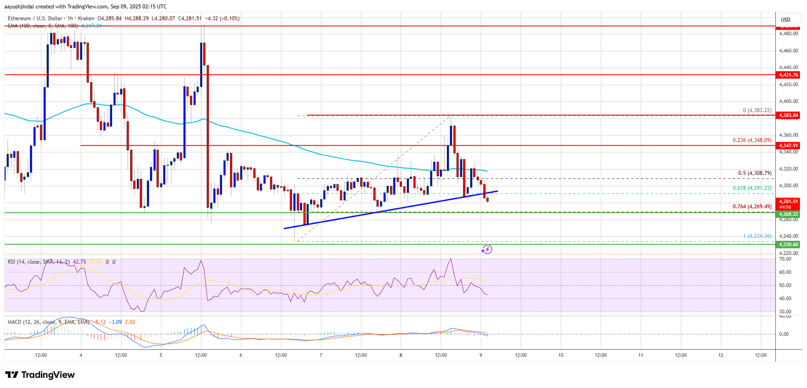 Ethereum Price Struggles Badly – More Downside Risk if Support Fails Ethereum Price Struggles Badly – More Downside Risk if Support Fails